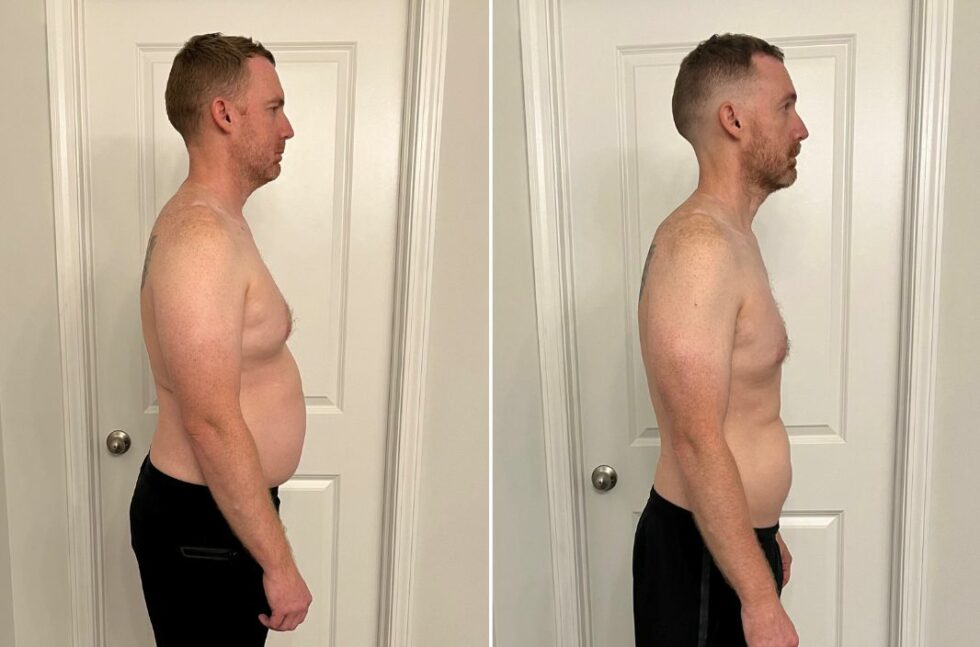 Weight Loss Surgery In Columbia Sc
